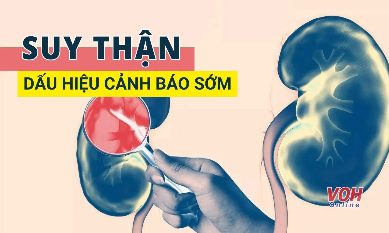 Suy thận chữa được không? Dấu hiệu cảnh sớm của bệnh