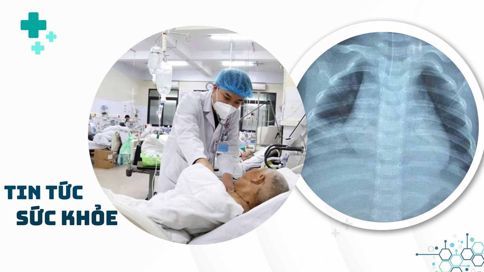 Nhịp Sống Khỏe 3/2: Bé trai nguy kịch do uống dầu hỏa | Ngừng tim, ngừng thở do ăn lá ngón