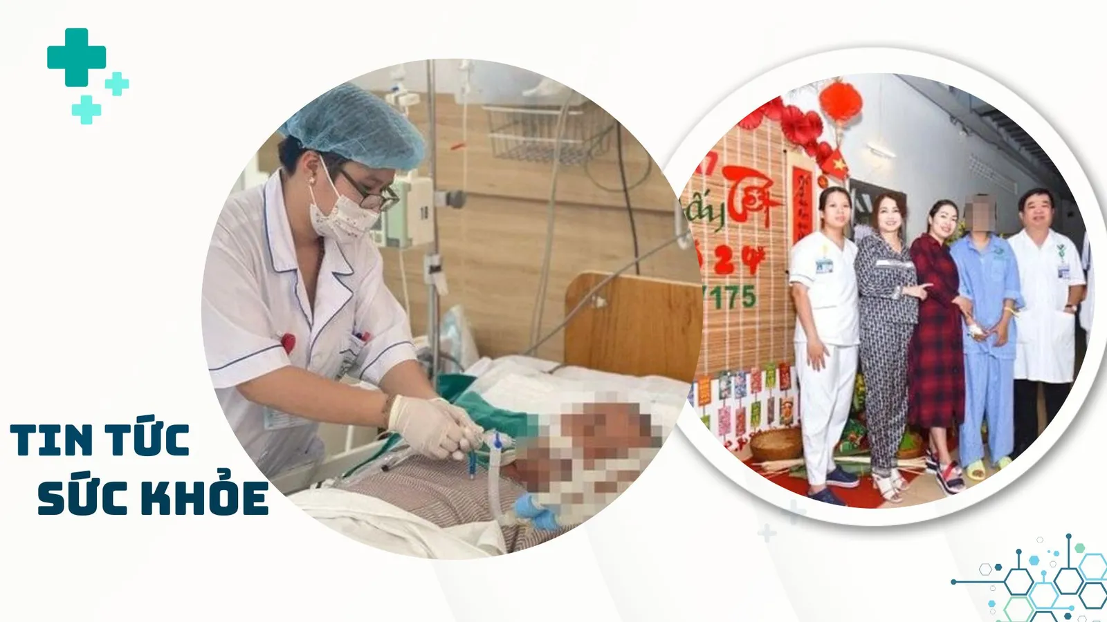 Nhịp Sống Khỏe 5/2: Thiếu nữ 18 tuổi bị đột quỵ | Cảnh báo ngộ độc rượu cận Tết