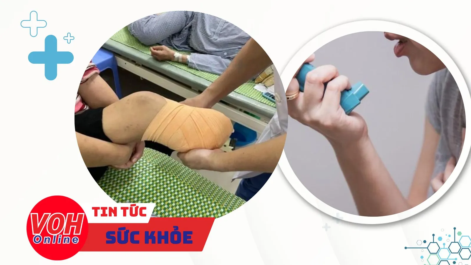 Nhịp Sống Khỏe 27/2: Cảnh báo viêm thanh quản cấp ở trẻ | Nhiều bệnh nhân đái tháo đường biến chứng nặng sau Tết