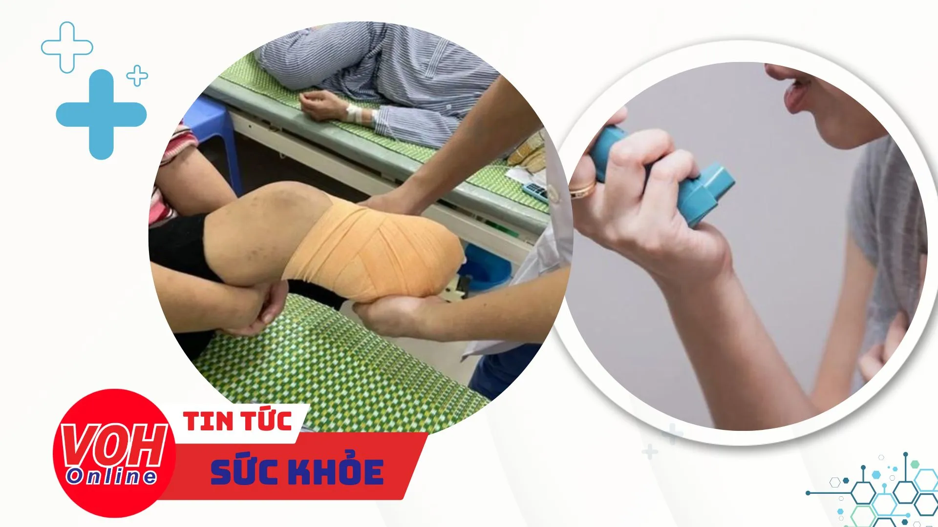 Nhịp Sống Khỏe 26/2: Bị thủng dạ dày vì thói quen ăn đồ chua cay | Tử vong sau 2 tháng bị chó cắn