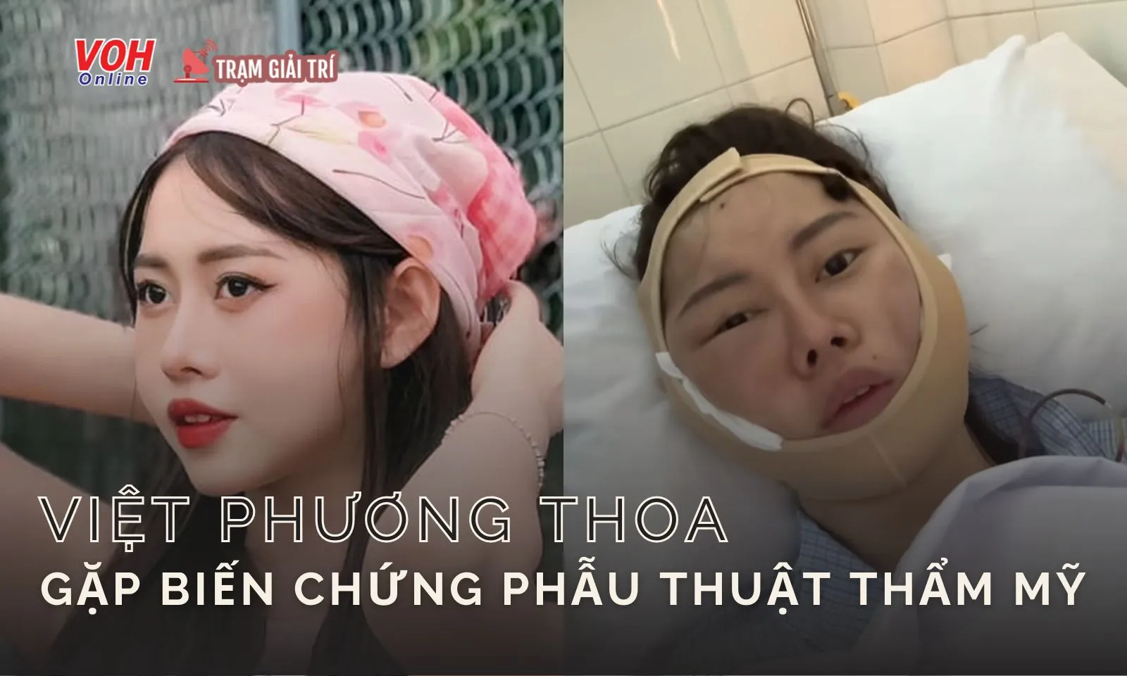 Hot tiktoker Việt Phương Thoa gặp biến chứng phẫu thuật thẩm mỹ