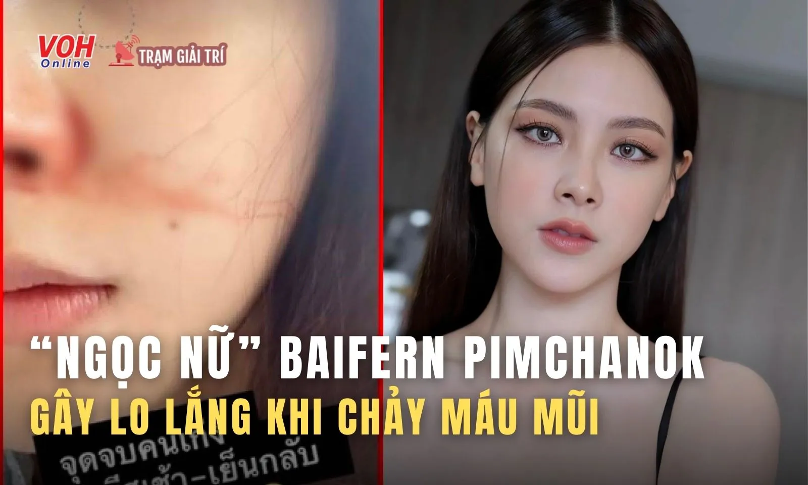 Mỹ nhân không góc chết Baifern Pimchanok đăng ảnh chảy máu mũi khiến fan lo lắng