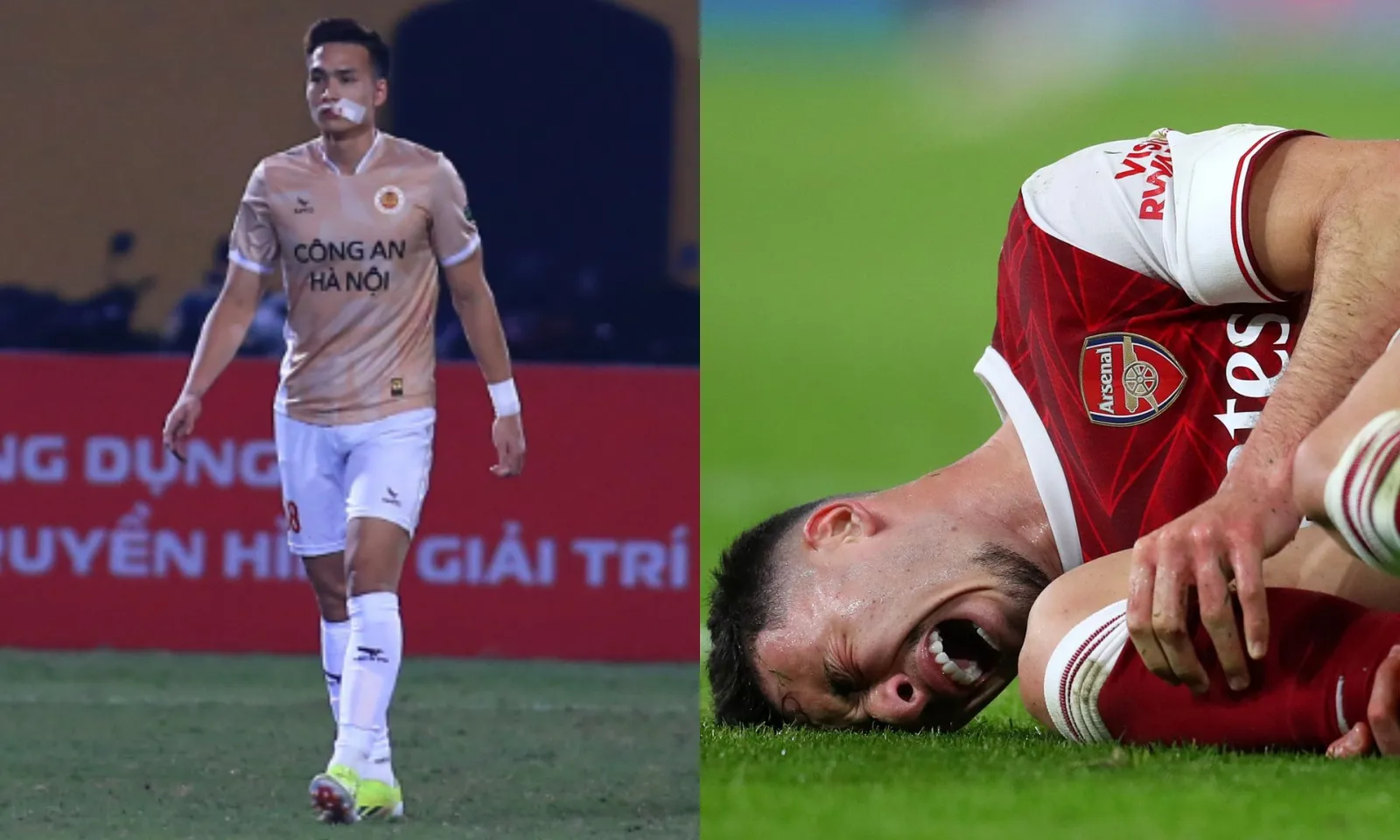 Điểm tin bóng đá 10/3: Ngôi sao tuyển Việt Nam phải khâu 24 mũi | Arsenal đón tin dữ