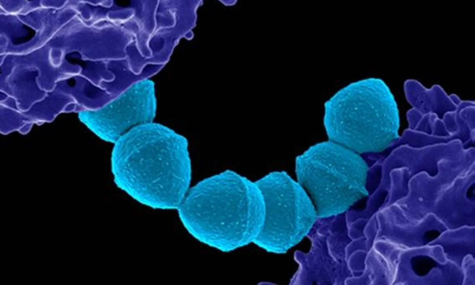 Nhật Bản cảnh báo vi khuẩn STSS gây chết người gia tăng