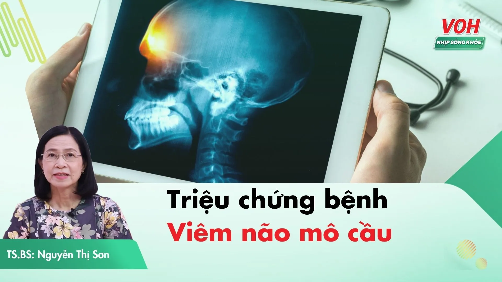 Những triệu chứng nguy hiểm cần lưu ý của bệnh viêm não mô cầu